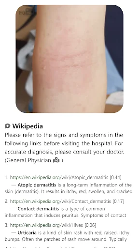 ดาวน์โหลด Model Dermatol ล่าสุด – ตรวจโรคผิวหนังด้วยภาพฟรี - Screenshot 13