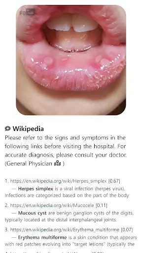 ดาวน์โหลด Model Dermatol ล่าสุด – ตรวจโรคผิวหนังด้วยภาพฟรี - Screenshot 15