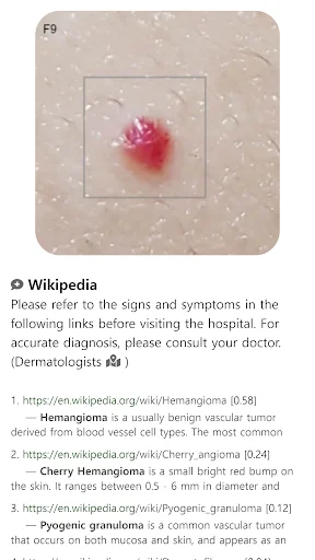 ดาวน์โหลด Model Dermatol ล่าสุด – ตรวจโรคผิวหนังด้วยภาพฟรี - Screenshot 11