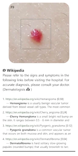 ดาวน์โหลด Model Dermatol ล่าสุด – ตรวจโรคผิวหนังด้วยภาพฟรี - Screenshot 5
