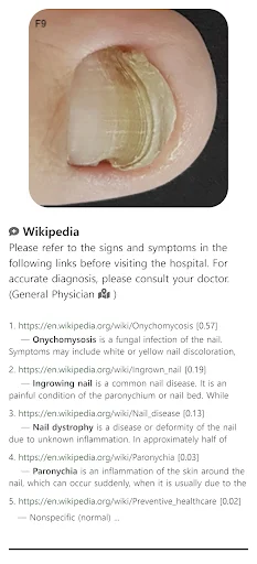 ดาวน์โหลด Model Dermatol ล่าสุด – ตรวจโรคผิวหนังด้วยภาพฟรี - Screenshot 1