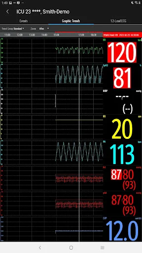 ดาวน์โหลด Mindray Mobile Viewer ล่าสุด – ระบบติดตามผู้ป่วยอัจฉริยะ - Screenshot 23