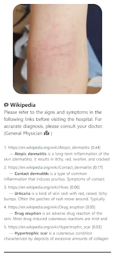 ดาวน์โหลด Model Dermatol ล่าสุด – ตรวจโรคผิวหนังด้วยภาพฟรี - Screenshot 7