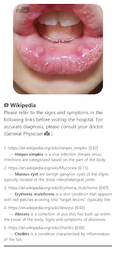 ดาวน์โหลด Model Dermatol ล่าสุด – ตรวจโรคผิวหนังด้วยภาพฟรี - Screenshot 8