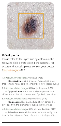ดาวน์โหลด Model Dermatol ล่าสุด – ตรวจโรคผิวหนังด้วยภาพฟรี - Screenshot 3