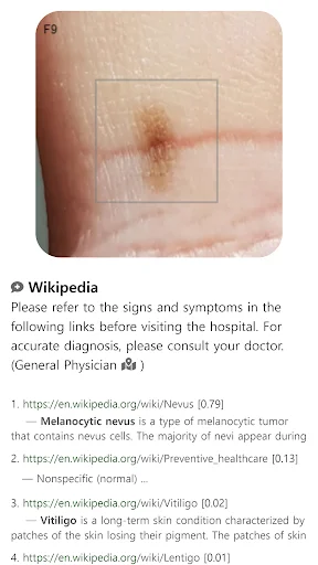 ดาวน์โหลด Model Dermatol ล่าสุด – ตรวจโรคผิวหนังด้วยภาพฟรี - Screenshot 10