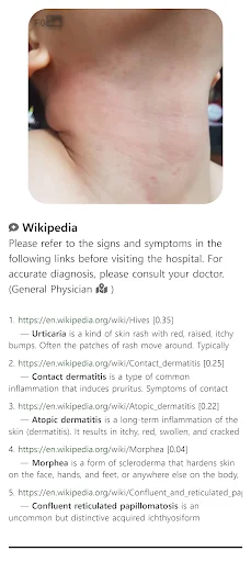 ดาวน์โหลด Model Dermatol ล่าสุด – ตรวจโรคผิวหนังด้วยภาพฟรี - Screenshot 6