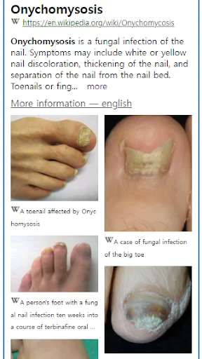 ดาวน์โหลด Model Dermatol ล่าสุด – ตรวจโรคผิวหนังด้วยภาพฟรี - Screenshot 2