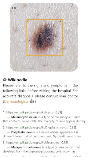 ดาวน์โหลด Model Dermatol ล่าสุด – ตรวจโรคผิวหนังด้วยภาพฟรี - Screenshot 9