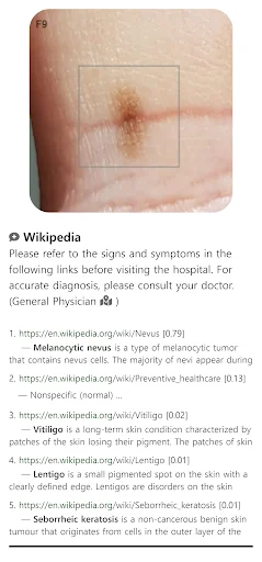 ดาวน์โหลด Model Dermatol ล่าสุด – ตรวจโรคผิวหนังด้วยภาพฟรี - Screenshot 4